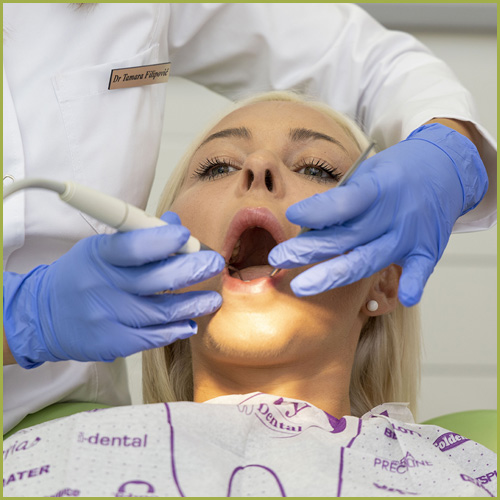 Uklanjanje zubnog kamenca i poliranje zuba